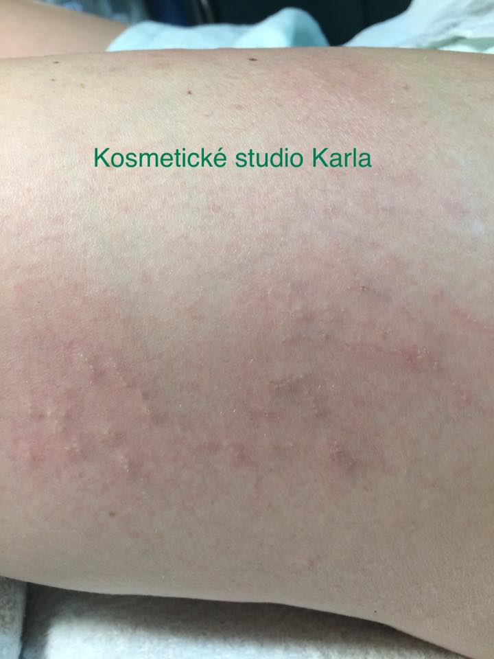 PO OŠETŘENÍ PO OŠETŘENÍ