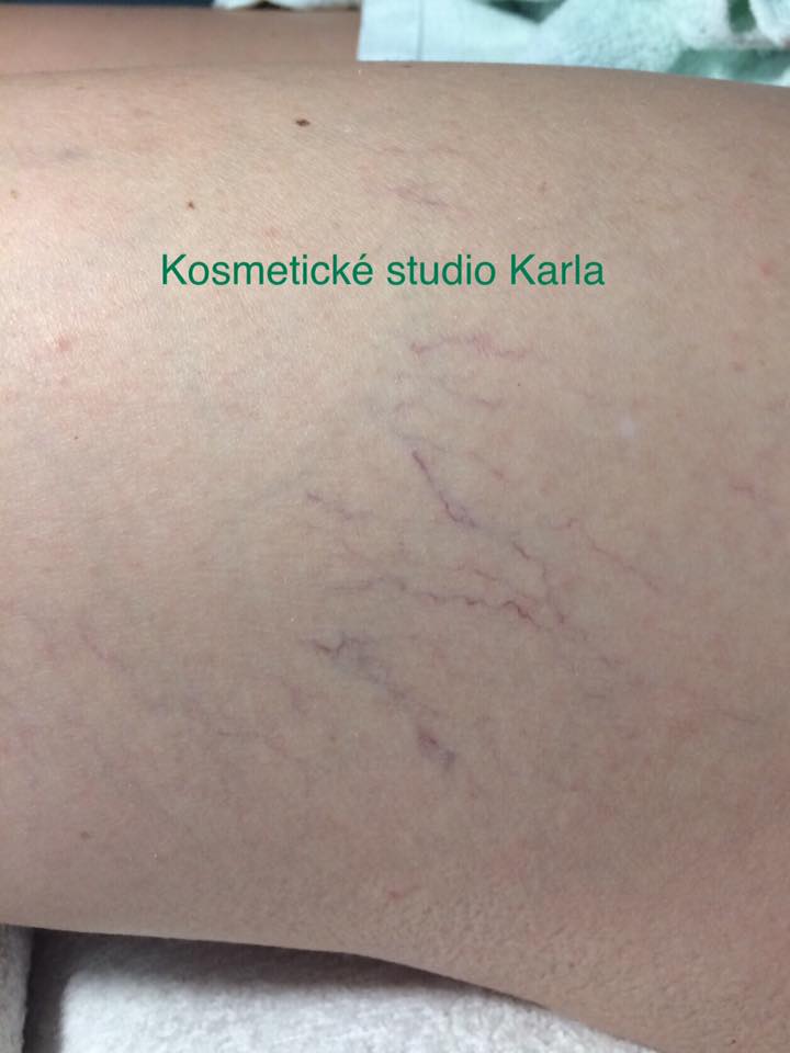 PŘED OŠETŘENÍM PŘED OŠETŘENÍM